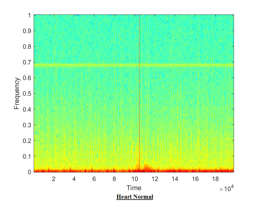 Heart Sound detection